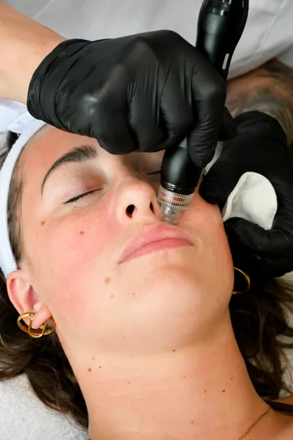 waterstofbehandeling zaltbommel